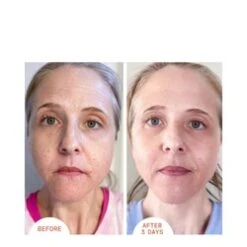 Dr Dennis Gross Alpha Beta Peel Extra Strength -LushSkin Shop Alpha Beta Peel Extra Strength add2 26579 3958 general