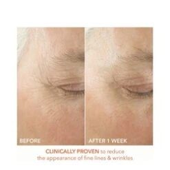 Dr Dennis Gross Alpha Beta Ultra Gentle Daily Peel -LushSkin Shop Alpha Beta Ultra Gentle Daily Peel add2 65347 812 general