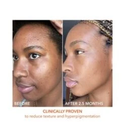 Dr Dennis Gross Alpha Beta Universal Daily Peel -LushSkin Shop Alpha Beta Universal Daily Peel add4 55577 3617 general