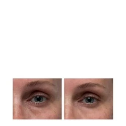 Dr Dennis Gross Hyaluronic Marine Dew It Right Eye Gel - Image 3