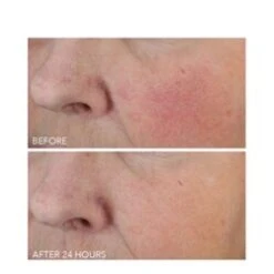 Dr Dennis Gross Vitamin C + Lactic Dewy Deep Cream 9 Dr Dennis Gross Vitamin C + Lactic Dewy Deep Cream -LushSkin Shop Vitamin C Lactic Dewy Deep Cream add3 68793 6217 general