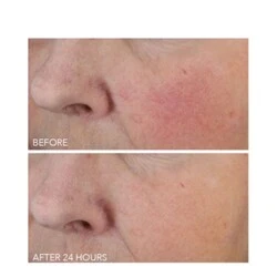 Dr Dennis Gross Vitamin C + Lactic Dewy Deep Cream 6 Dr Dennis Gross Vitamin C + Lactic Dewy Deep Cream - Image 4